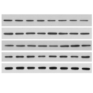 蛋白質(zhì)免疫印跡(Western Blot, WB )